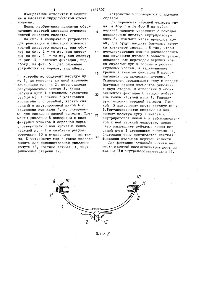 Устройство для репозиции и фиксации отломков костей лицевого скелета (патент 1187807)