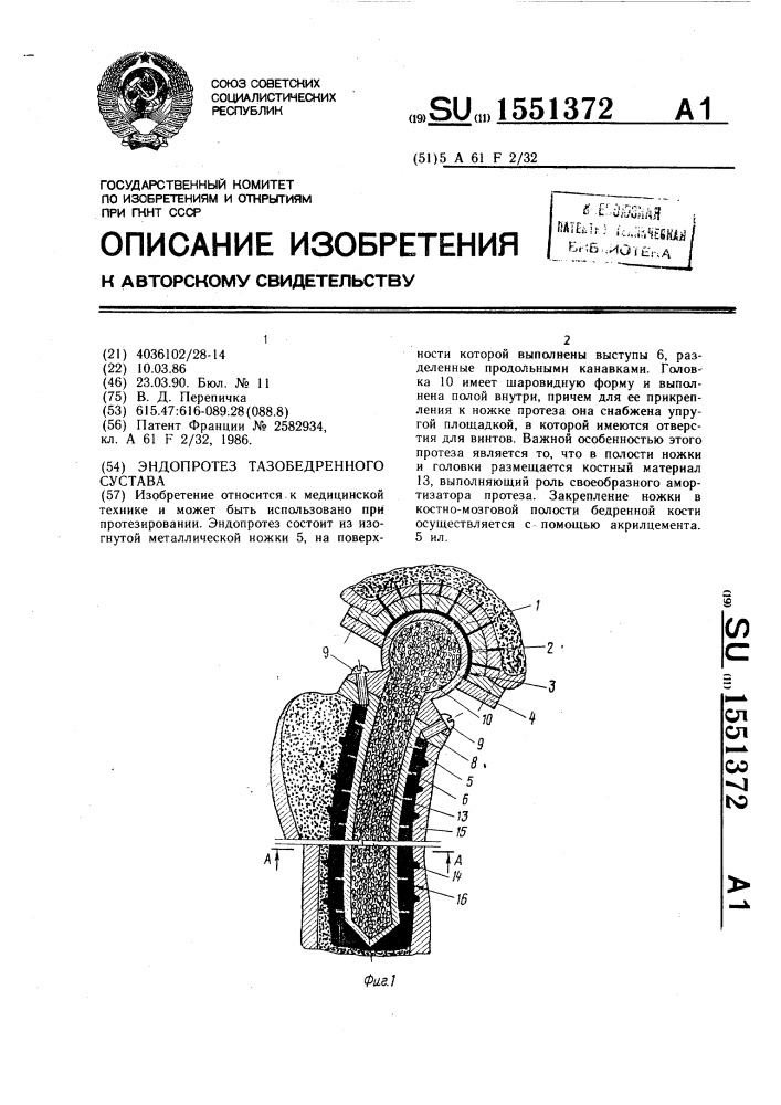 Эндопротез тазобедренного сустава (патент 1551372)