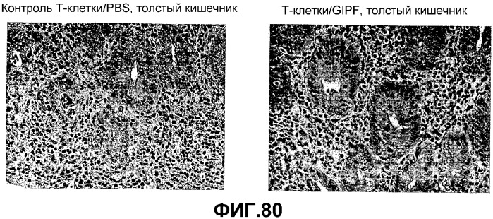 Желудочно-кишечный пролиферативный фактор и его применения (патент 2343158)