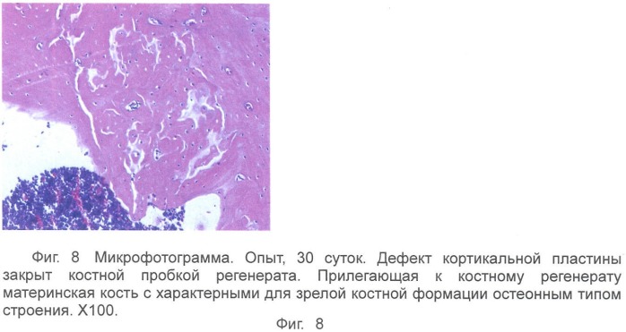 Гель для регенерации костной ткани (патент 2360663)