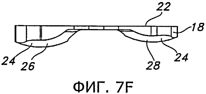 Способы и устройства для артропластики коленного сустава (патент 2583369)