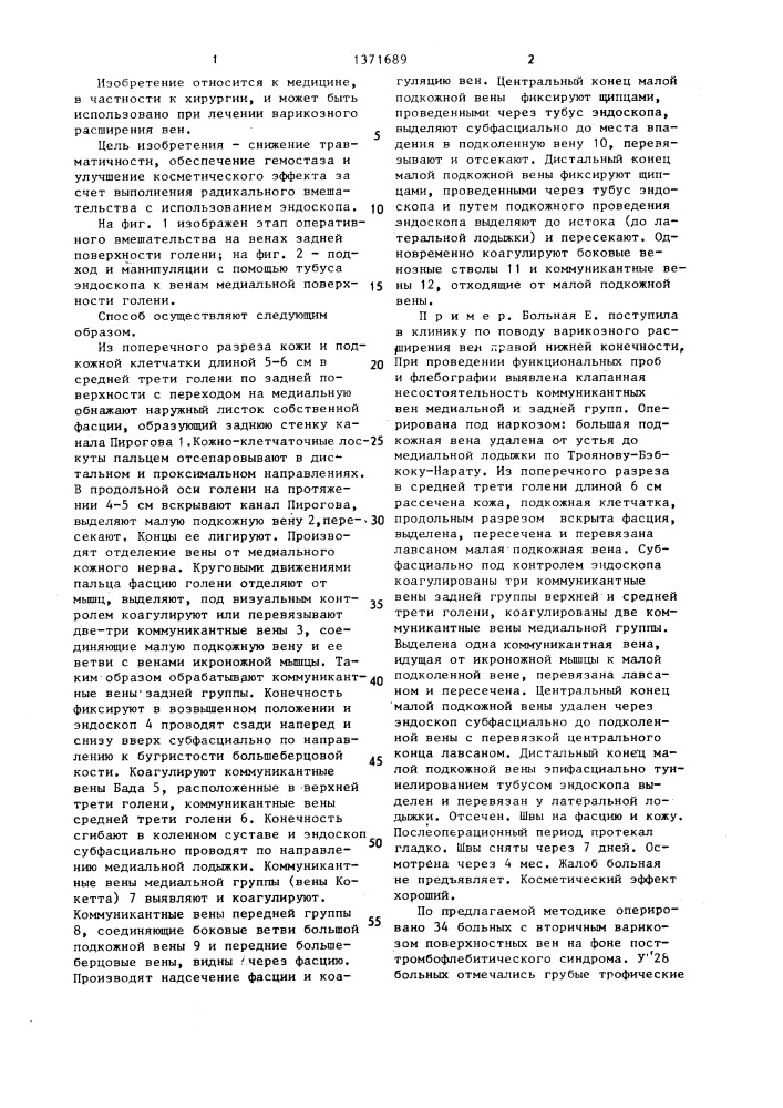 Способ лечения варикозного расширения вен (патент 1371689)