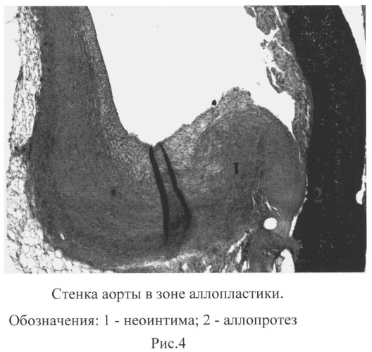 Способ оценки функционального состояния эндотелия экспериментальных животных после реконструктивных операций на брюшной аорте (патент 2503961)