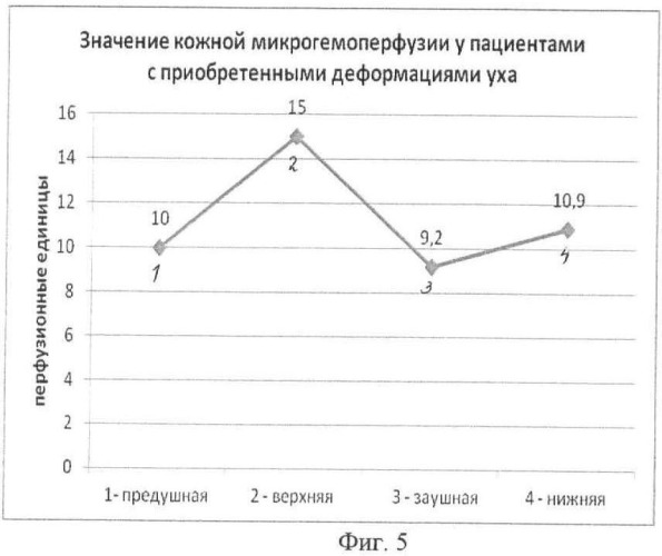 Способ определения кожной микроциркуляции в околоушной области у больных с врожденными пороками уха и приобретенными деформациями ушной раковины (патент 2462994)