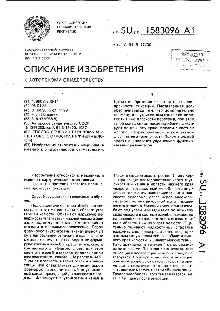 Способ лечения перелома мыщелкового отростка нижней челюсти (патент 1583096)