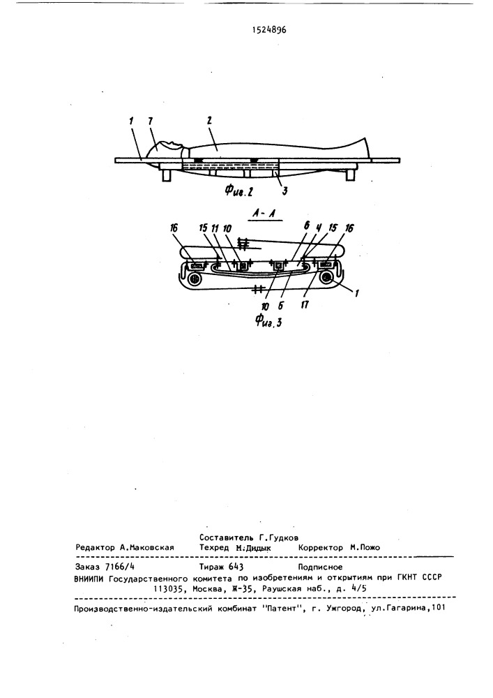 Устройство для транспортировки пострадавшего (патент 1524896)