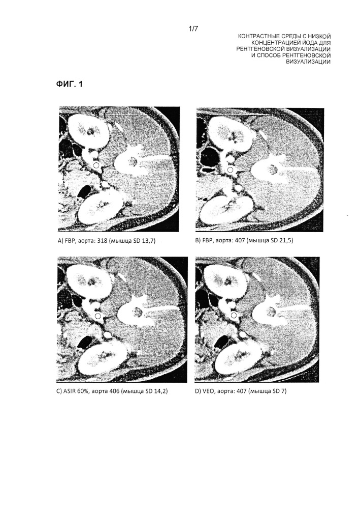 Контрастные среды с низкой концентрацией йода для рентгеновской визуализации и способ рентгеновской визуализации (патент 2664418)