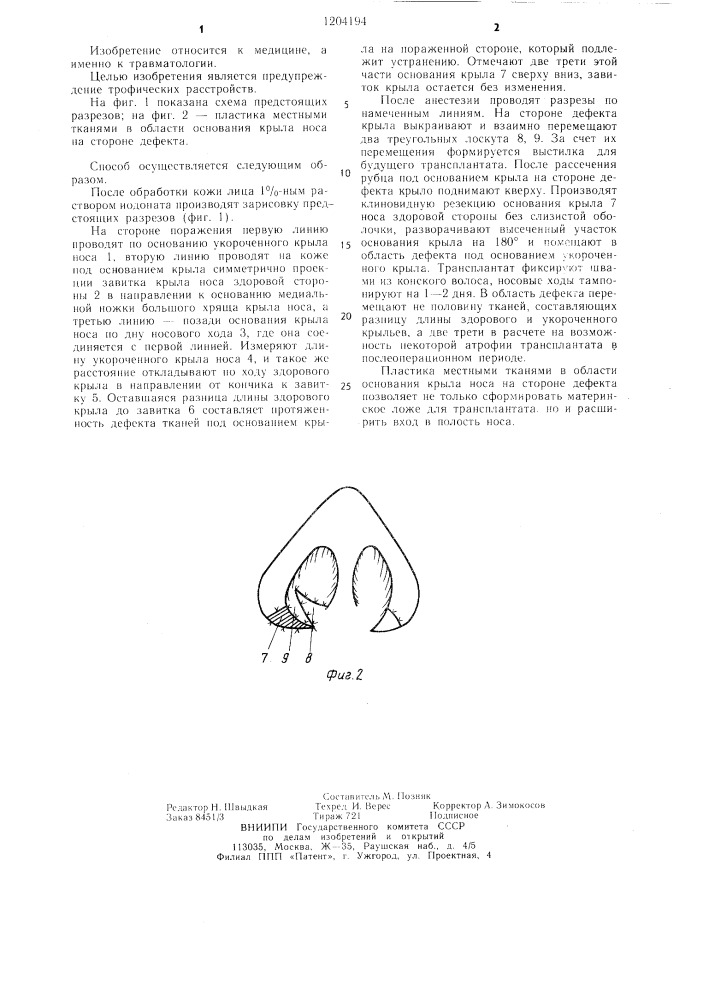 Способ коррекции основания крыльев носа (патент 1204194)