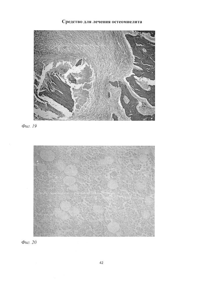 Средство для лечения остеомиелита (патент 2604124)