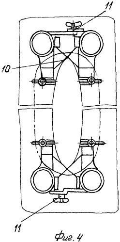 Ранорасширитель-сузитель (патент 2339322)