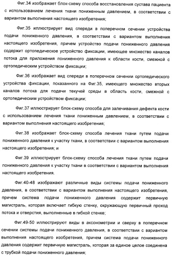 Способ лечения путем подкожной подачи пониженного давления с использованием разделения с помощью воздушного баллона (патент 2405588)