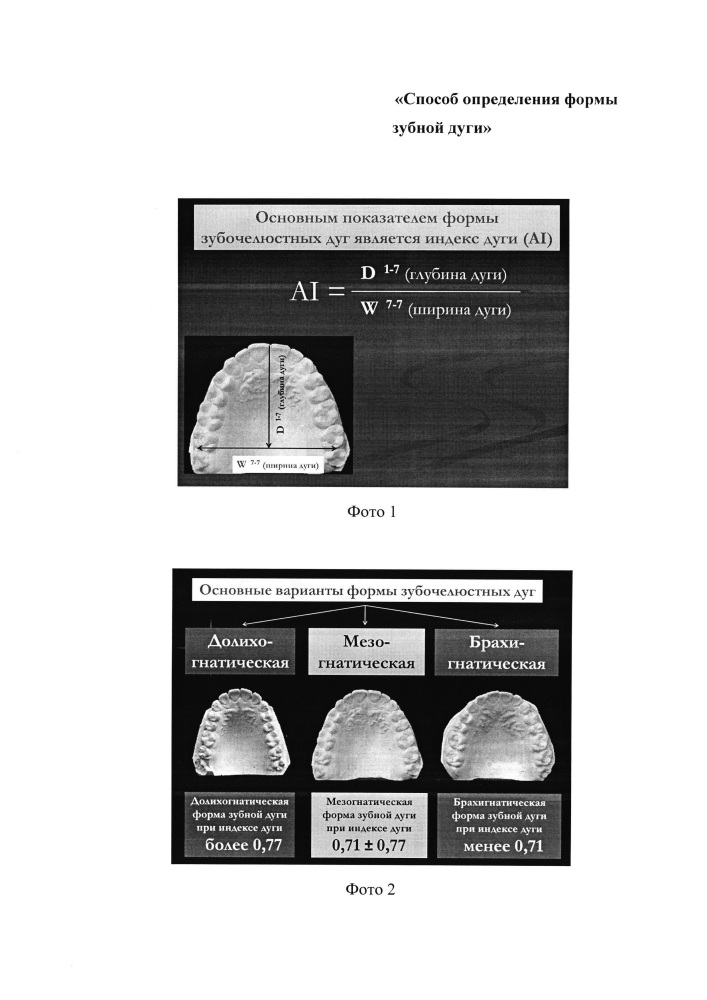 Способ определения формы зубной дуги (патент 2653792)
