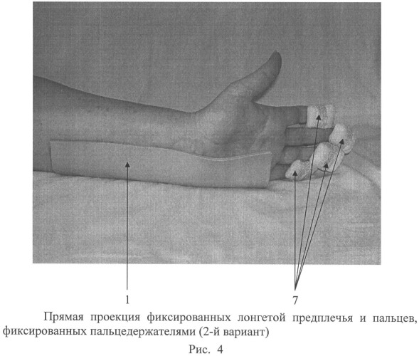 Устройство для разработки лучезапястного сустава и пальцев кисти (патент 2487695)