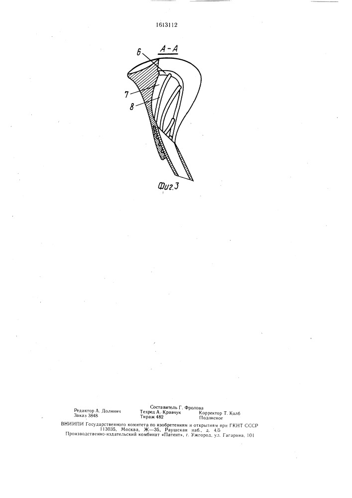 Обтуратор фарингостомы (патент 1613112)