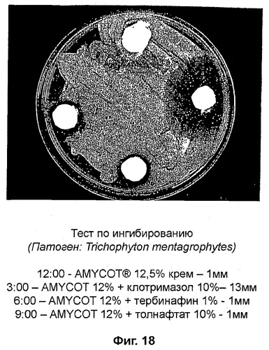 Композиции на основе arthrospira и их применение (патент 2412990)