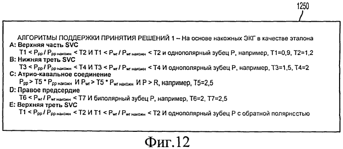 Способ позиционирования конца катетера (патент 2549998)