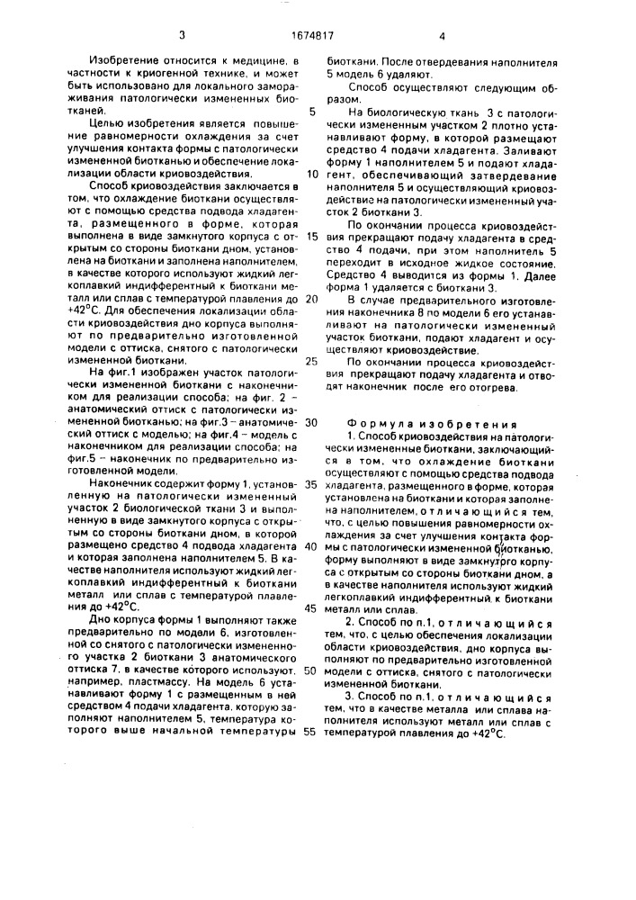 Способ криовоздействия на патологически измененные биоткани (патент 1674817)