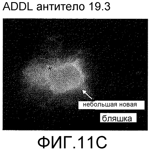 Моноклональное антитело против addl и его применения (патент 2567808)