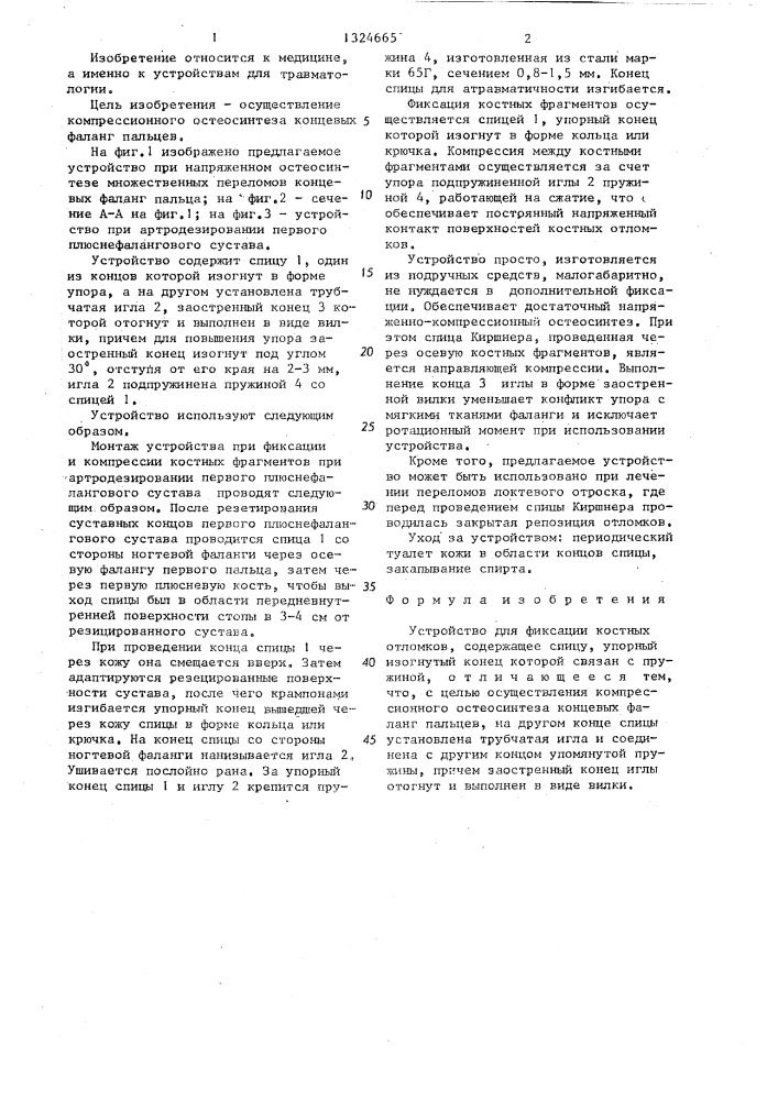 Устройство для фиксации костных отломков (патент 1324665)
