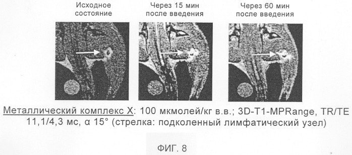 Применение перфторалкилсодержащих комплексов металлов в качестве контрастных веществ в магнитно-резонансной томографии для визуализации бляшек, опухолей и некрозов (патент 2290206)