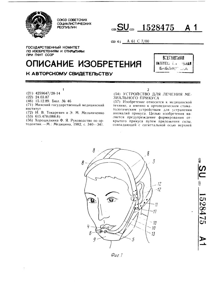 Устройство для лечения мезиального прикуса (патент 1528475)
