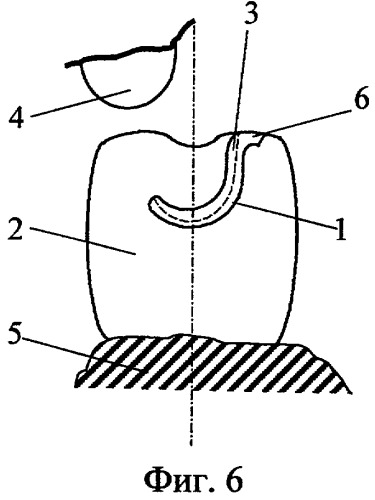 Аттачмен (варианты) (патент 2251992)