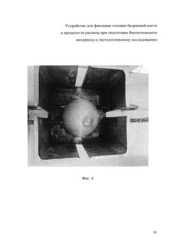 Устройство для фиксации головки бедренной кости в процессе ее распила для подготовки биологического материала к гистологическому исследованию (патент 2593158)
