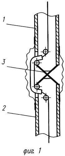 Ортопедический аппарат для коленного сустава (патент 2309708)