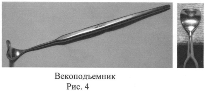 Способ овариогистерэктомии кошек по боковому доступу (патент 2396923)