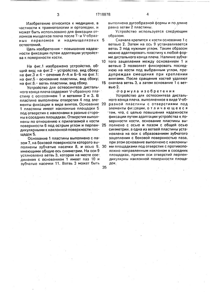 Устройство для остеосинтеза дистального конца плеча (патент 1718878)