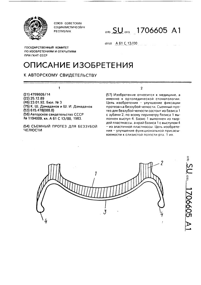 Съемный протез для беззубой челюсти (патент 1706605)