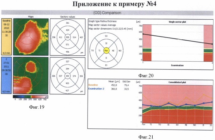 Способ комбинированного лечения диабетического диффузного макулярного отека (патент 2486878)