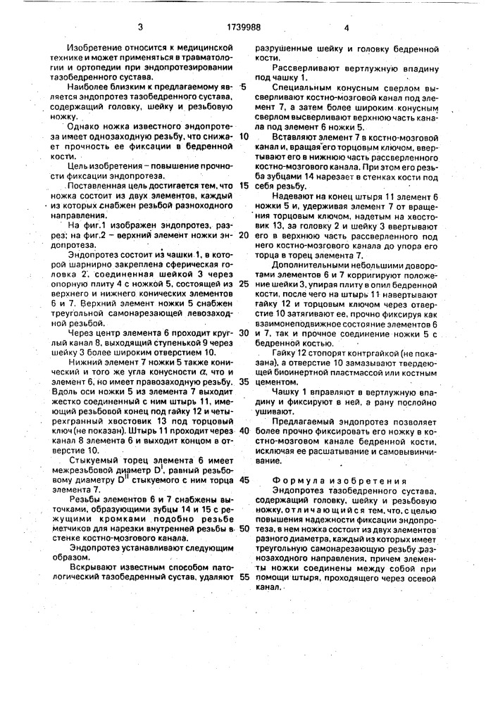 Эндопротез тазобедренного сустава (патент 1739988)