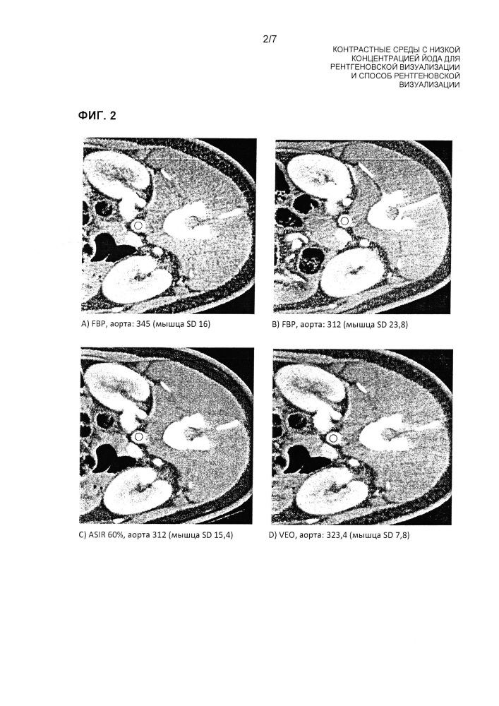 Контрастные среды с низкой концентрацией йода для рентгеновской визуализации и способ рентгеновской визуализации (патент 2664418)