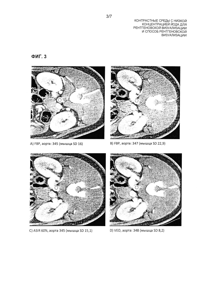 Контрастные среды с низкой концентрацией йода для рентгеновской визуализации и способ рентгеновской визуализации (патент 2664418)