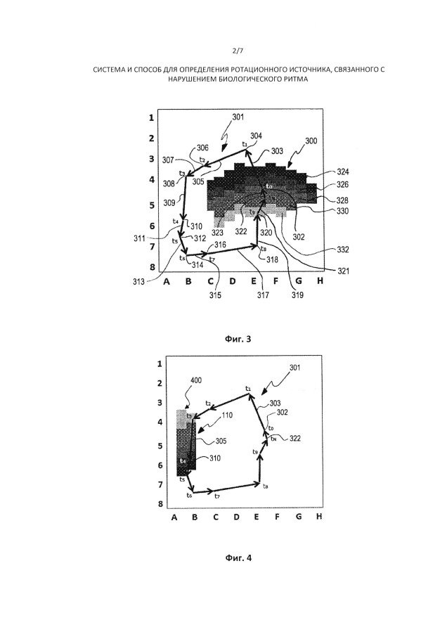 Система и способ для определения ротационного источника, связанного с нарушением биологического ритма (патент 2593892)