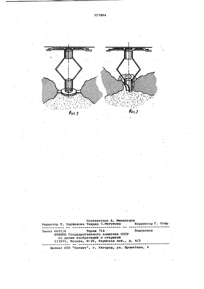 Протез слуховых косточек (патент 957894)