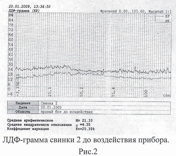 Способ лечения кожных заболеваний с использованием магнитных пленок феррит-гранатов (патент 2447911)