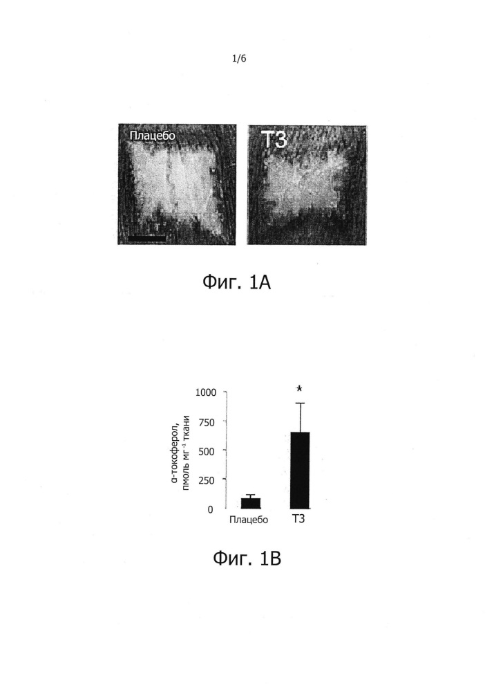 Способ лечения ожоговых и рубцовых повреждений с применением токотриенольных композиций (патент 2638793)