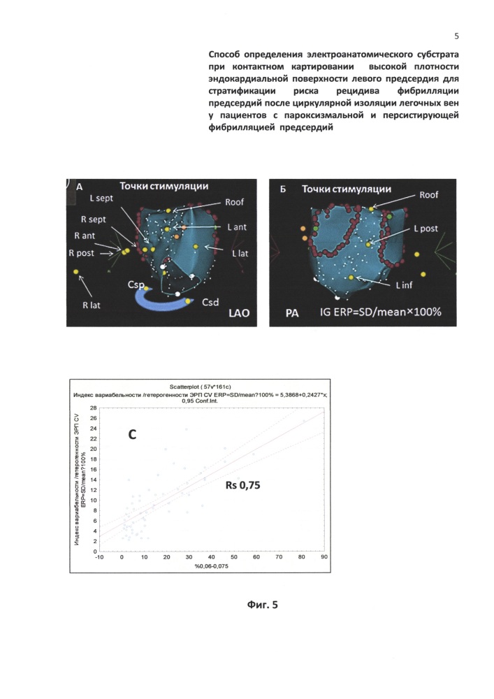 Способ определения электроанатомического субстрата при контактном картировании высокой плотности эндокардиальной поверхности левого предсердия для стратификации риска рецидива фибрилляции предсердий после циркулярной изоляции легочных вен у пациентов с пароксизмальной и персистирующей фибрилляцией предсердий (патент 2649506)