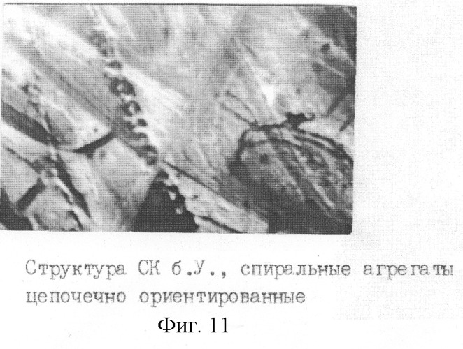 Способ экспресс-диагностики гипер-бета 2-микроглобулинемии (патент 2259565)