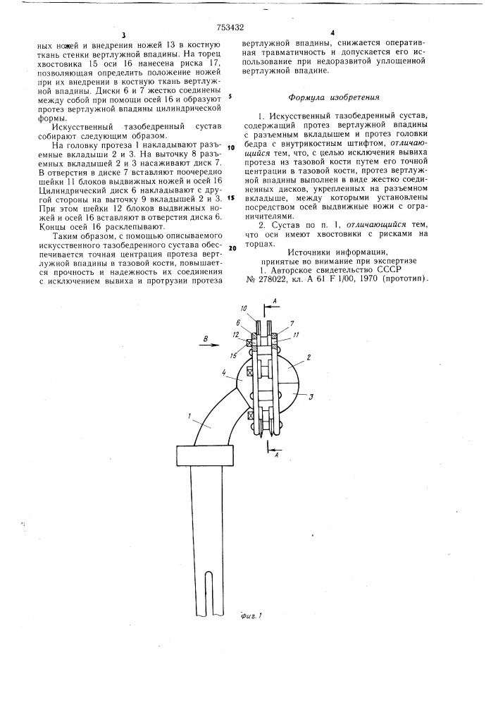 Искусственный тазобедренный сустав (патент 753432)