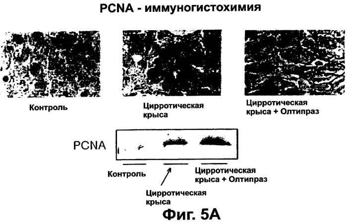 Фармацевтическая композиция для регенерации цирротической печени (патент 2291696)