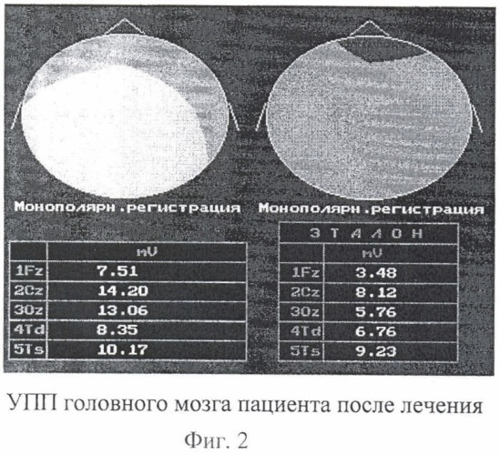 Фармацевтическая композиция, включающая холина альфосцерат и гопантеновую кислоту (или ее соль), для лечения недостаточности кровообращения мозга и эректильной дисфункции (патент 2391095)