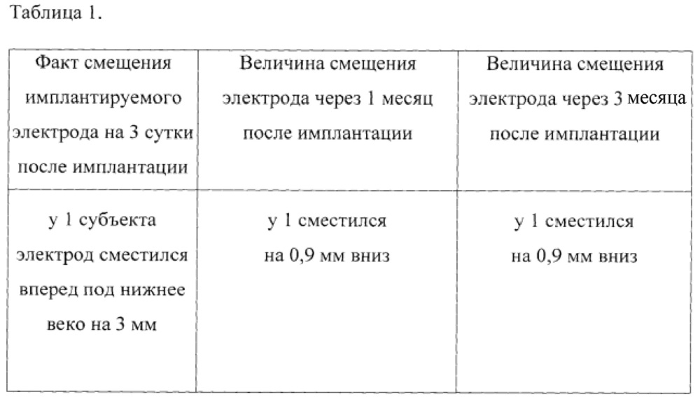 Электрод для электростимуляции зрительного нерва и зрительных путей и контроля физиологических параметров орбитальных структур глаза, способ его использования и устройство для электростимуляции (патент 2620154)