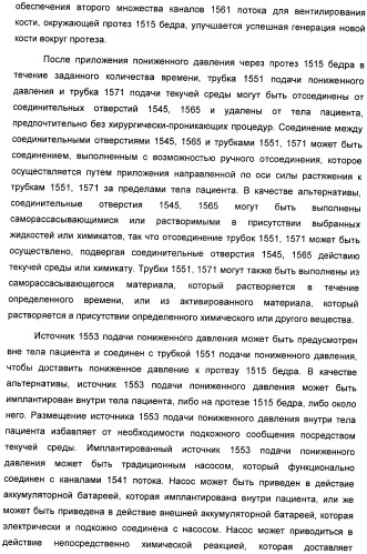 Система и способ продувки устройства пониженного давления во время лечения путем подачи пониженного давления (патент 2404822)