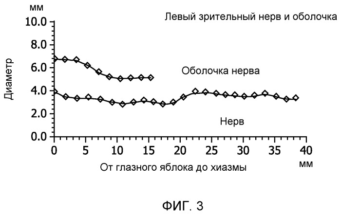 Классификация изображения на основе сегментации изображения (патент 2513905)