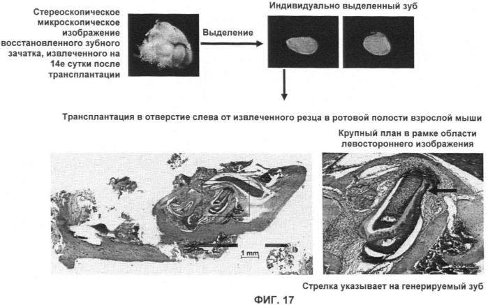 Способ формирования зуба, зубной ряд и способ формирования ткани (патент 2428140)