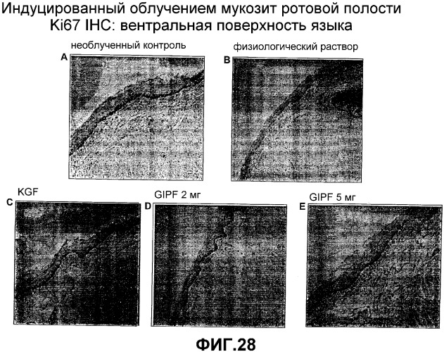 Желудочно-кишечный пролиферативный фактор и его применения (патент 2343158)