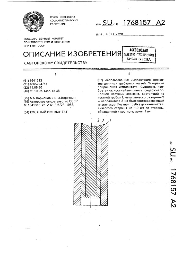 Костный имплантат (патент 1768157)